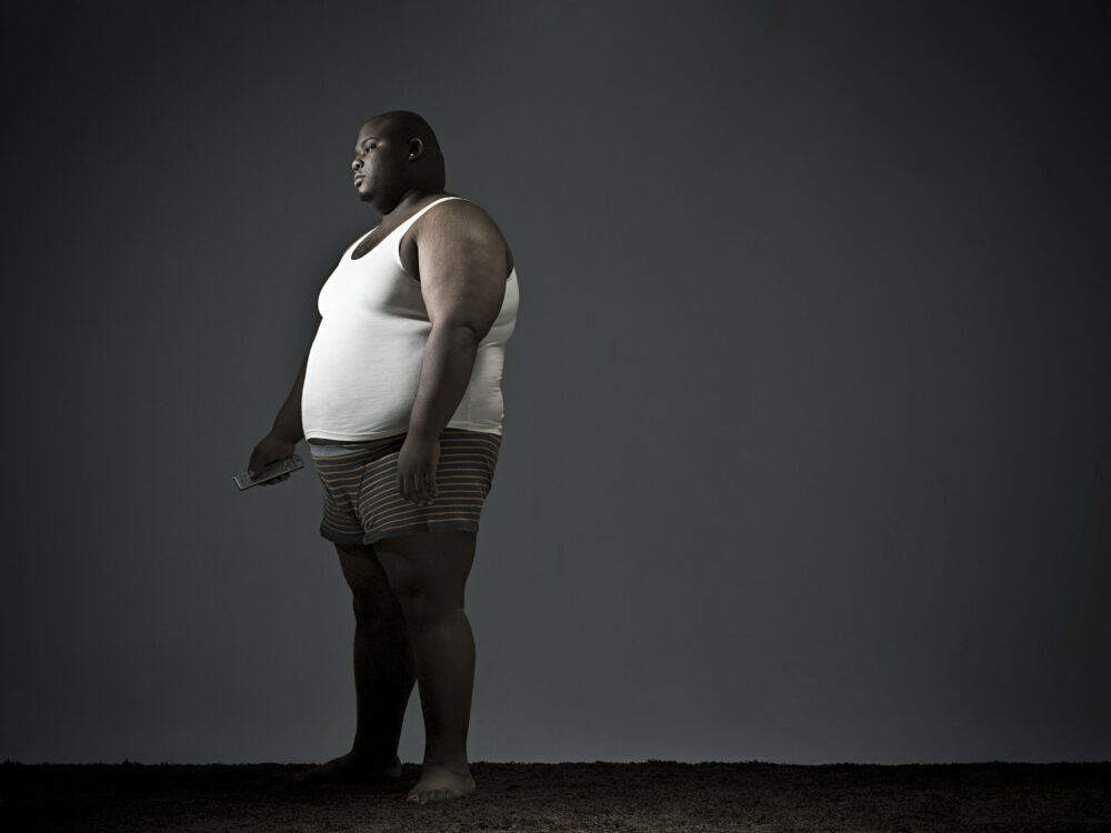 Obesity goes far beyond appearance it’s a serious health issue in the United States.